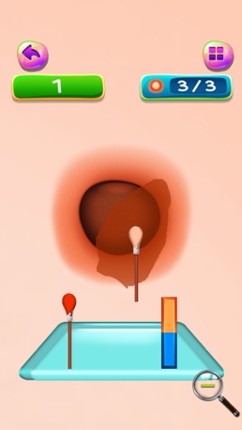 Pimples and Blackheads Removal : get rid of pimples from nose and face ! FREE screenshot