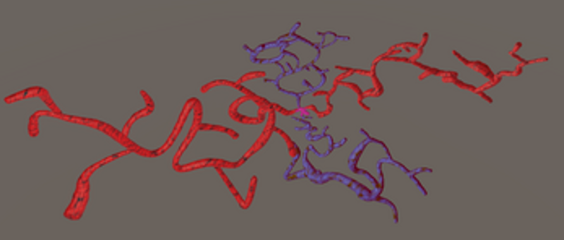 The Maze of a Bloodstream screenshot