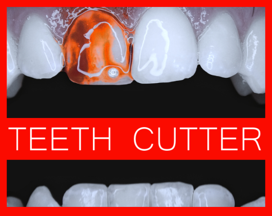 Teeth Cutter Image