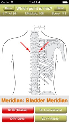 Acupuncture Points Quiz Image