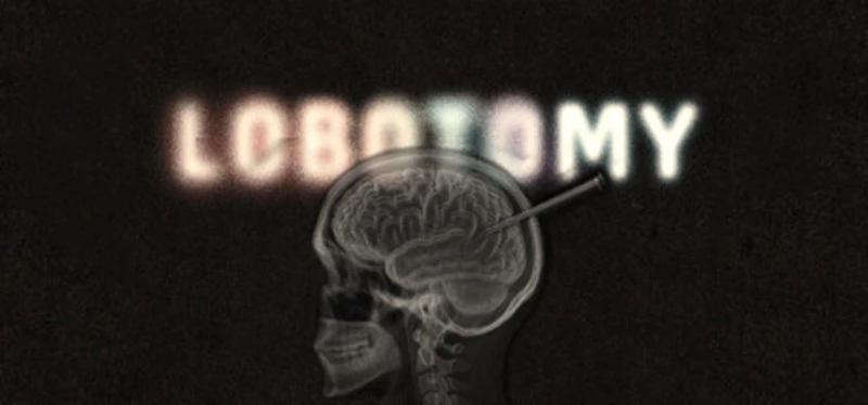 Lobotomy Image