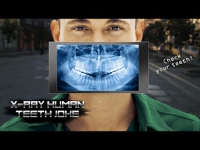 X-Ray Human Teeth Joke Image