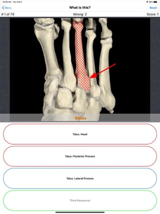 Anatomy Foot Quiz Image