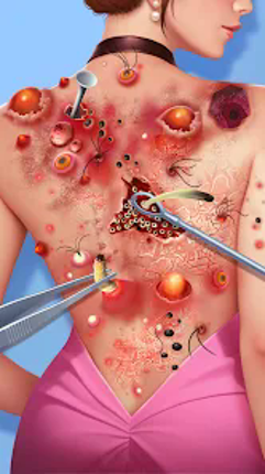 Screw Match®: ASMR Blast Image
