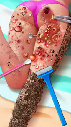 Screw Match®: ASMR Blast Image