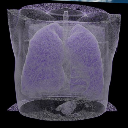 Bodyscope screenshot