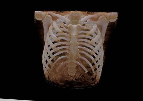 Bodyscope screenshot