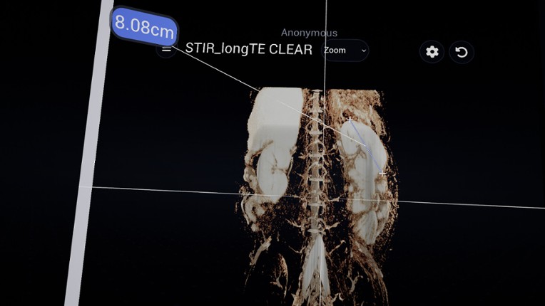 Bodyscope screenshot
