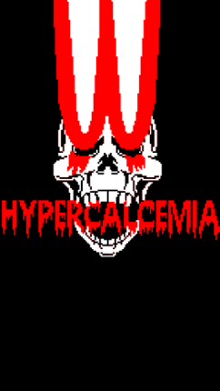 Hypercalcemia Image