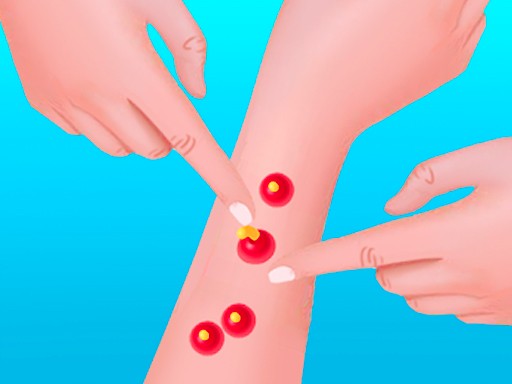 Games like Pimple Poper Rush