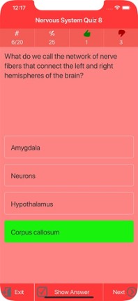 Human Nervous System Trivia Image