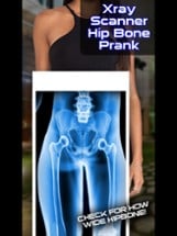 Xray Scanner Hip Bone Prank Image