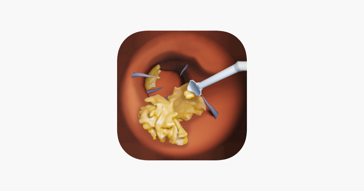 Games like Endoscope cleaning ear