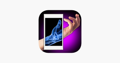 Xray Fracture Hand Prank Image