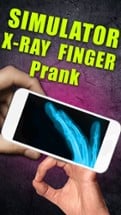 Simulator X-Ray - Finger Prank Image