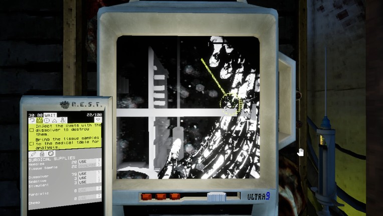 Ultrasound screenshot