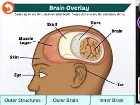 Rebound: Beating Concussions Image