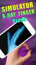 Simulator X-Ray - Finger Prank Image