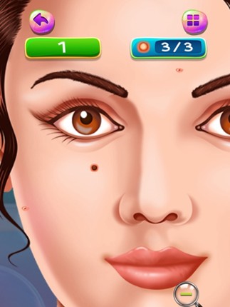 Pimples and Blackheads Removal : get rid of pimples from nose and face ! FREE screenshot