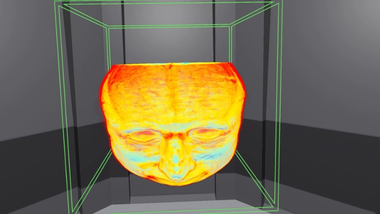 MedicalImagingVR screenshot