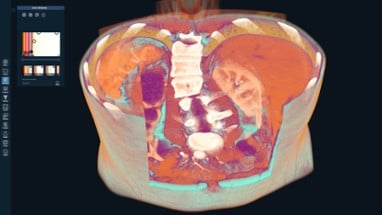 3D Organon Image