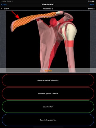 Anatomy Shoulder Quiz Image