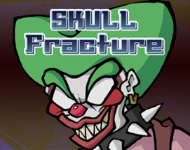 SKULLFracture Image