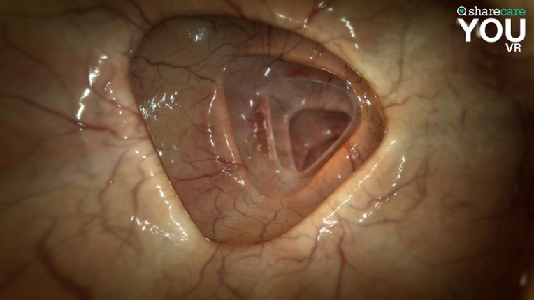 Sharecare YOU screenshot