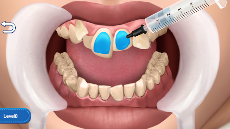 Clean Teeth Craze Image