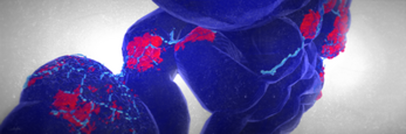 Apoptosis Image