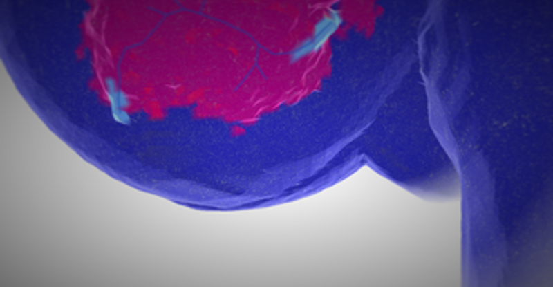Apoptosis Image