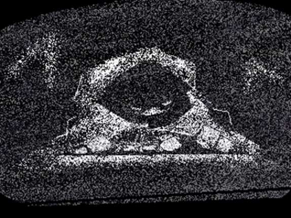 PSEUDOSOMNIA Image