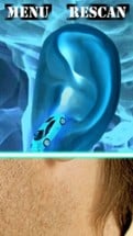 Xray Scanner Ear Prank Image