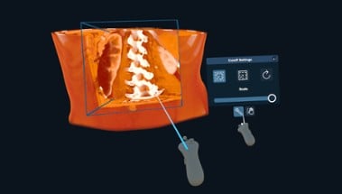 3D Organon XR Image