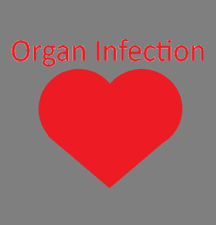 Games like OrganInfection