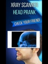 Xray Scanner Head Prank Image