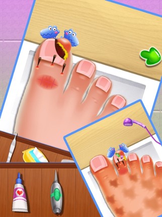 Nail doctor : Kids games toe surgery doctor games screenshot