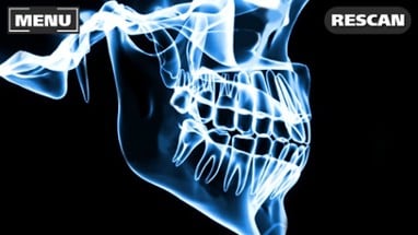 Xray Scanner Teeth Prank Image