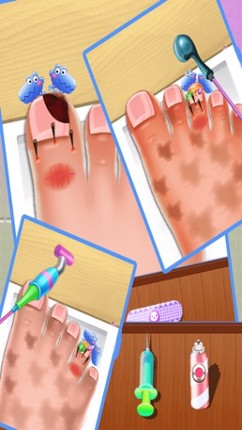Nail doctor : Kids games toe surgery doctor games screenshot