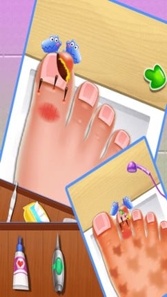 Nail doctor : Kids games toe surgery doctor games Image