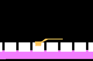 Tooth Protectors Image