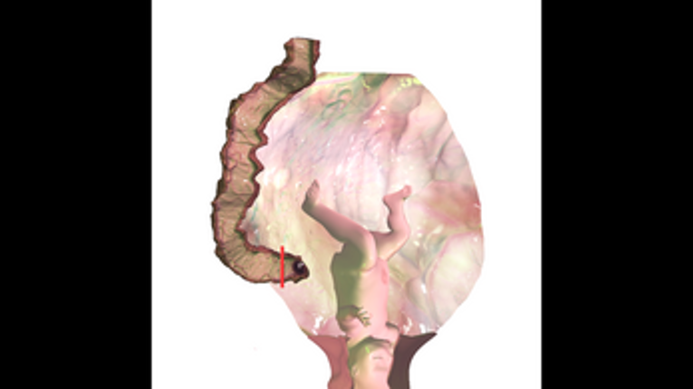 Ƀ@ɃØɌŦƗØN Image