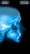 Xray Scanner Nose Prank Image