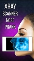 Xray Scanner Nose Prank Image